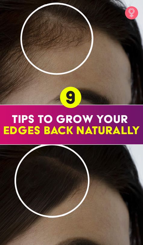 9 Tips To Grow Your Edges Back Naturally: How can you grow your edges back? This fragile hair needs extra care. If you continue over-handling them by wearing tight hairstyles like braids or weaves, they may break off and eventually cause hair loss. Grow Edges, Hair Growth Methods, Thinning Edges, Stop Hair Breakage, Growing Healthy Hair, Breaking Hair, Hair Growing Tips, Edges Hair, New Hair Growth