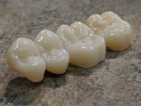 Crown And Bridge Dental Teeth, Zirconia Crowns Teeth, Dental Notes, Ceramic Stains, Dental Prosthesis, Aesthetic Dental, Dental Ceramics, Dental Wallpaper, Dental Images