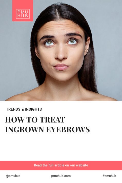 Ingrown hairs are the worst. They hurt, itch, burn, and they’re entirely impossible to ignore. When they’re also in super obvious places, like an ingrown hair in eyebrow, it can ruin your day in a snap. So, how do you deal with them? Fortunately, it’s fairly simple. Here’s why an ingrown hair in eyebrow can pop up in the first place, how to deal with it on your own, and when to ask for help. Ingrown Eyebrow Hair, Treat Ingrown Hair, Ingrown Hair Remedies, Ingrown Hair Removal, Ingrown Hairs, Hair Remedies, Professional Help, Deal With It, Ingrown Hair