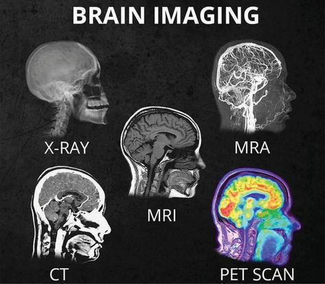 Home - San Diego Brain Injury Foundation Radiology Student, Brain Images, Pet Scan, Medical Student Study, Brain Facts, Medical School Inspiration, Medical School Essentials, Medical School Studying, Nursing School Notes