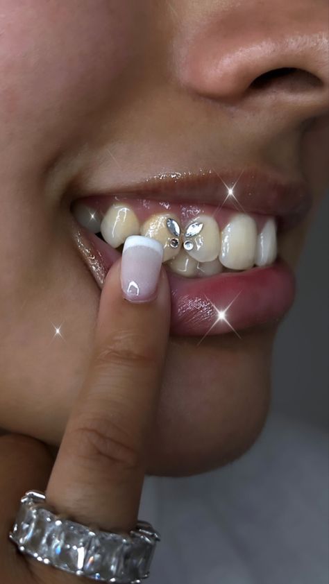 Teeth Jems Ideas, Tooth Jems Simple, Butterfly Teeth Gem, Flower Tooth Gem, Tooth Gem Inspo Simple, Bedazzled Retainer, Piercing No Dente, Strass Teeth, Tooth Gems Black Women