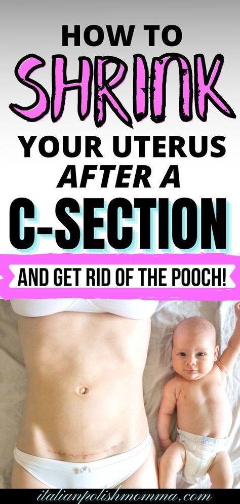 Want to know how to lose the c-section belly pooch and shrink your uterus fast? Find out how to shrink your uterus safely after birth and lose the c-section belly! Postpartum c-section tips from a mom that had 4 c-sections! | shrink uterus | postpartum belly | c-section recovery | c-section belly | C Section Pouch, C Section Belly, After C Section Workout, C Section Workout, C Section Recovery, Body After Baby, Loose Belly, Post Pregnancy Workout, Losing 40 Pounds