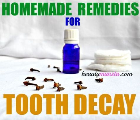 Can you reverse tooth decay naturally? Yes you can! And here are 3 tooth masks you can use to get you started! Reverse Tooth Decay, Tooth Extraction Aftercare, Tooth Extraction Healing, Baby Tooth Decay, Tooth Ache Relief, Sensitive Teeth Remedy, Tooth Decay Remedies, Remedies For Tooth Ache, Teeth Whitening Homemade