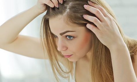 What does YOUR dandruff say about your health? Hair Transplant Women, Dunner Wordend Haar, Prp Hair, Hair Growth Cycle, Pattern Baldness, Oily Hair, Hair Replacement, Dry Scalp, Les Rides