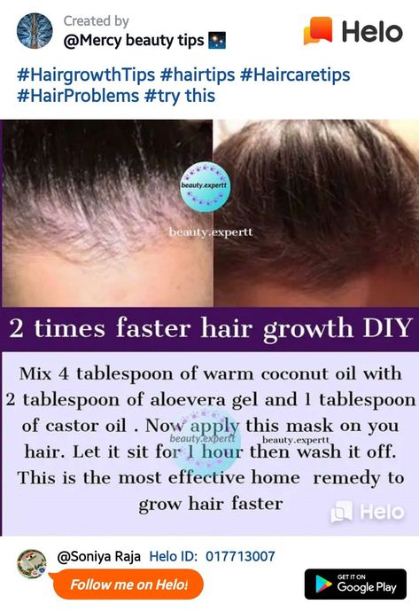 Faster Hair Growth, Homemade Hair Treatments, Hair Care Remedies, Hair Growth Secrets, Natural Skin Care Remedies, Hair Mask For Growth, Homemade Hair, Hair Growing Tips, Hair Remedies For Growth