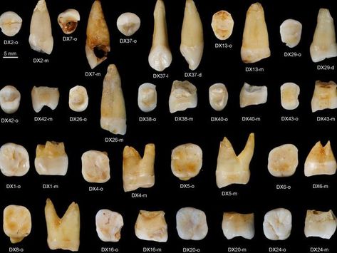 Ancient human teeth discovered in China could rewrite the historic migration map of Homo sapiens Human Teeth, African Continent, Dental Art, Creepy Crawlies, Human History, Tooth Decay, Tooth Fairy, Human, Art