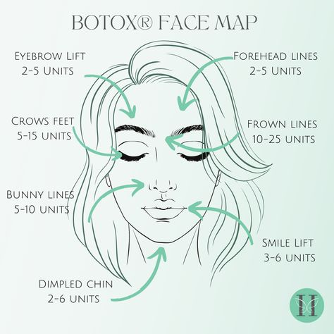 Botox Supplies, Botox Tips And Tricks, Botox Price List, Botox Images, How Many Units Of Botox Do I Need, Botox Face Mapping, Botox For Beginners, Botox Areas On Face, Botox Injection Sites Diagram