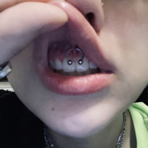 Smiley Piercing Men, Smilie Piercing Aesthetic, Persings Face, Piercing Aesthetic Face, Lobotomy Piercing, Rare Piercings, Body Mods Piercing, Dainty Face Piercings, Smiley Piercing Aesthetic