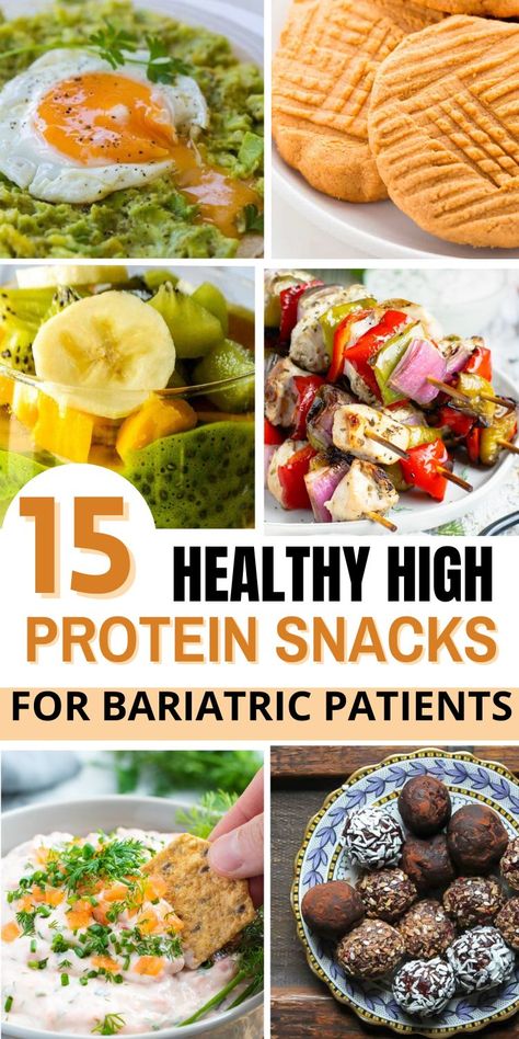 If you have recently had gastric bypass surgery and are looking for healthy snacks to eat, then you need these recipes! These are the best high-protein snacks for people who have had weight loss surgery.Gastric Bypass Snacks.Protein Snacks Recipes.Gastric Bypass Recipes.Healthy High Protein Snacks.Healthy High Protein Snacks Caloric Bypass Diet, Bariatric Snack Recipes, Gastric Bypass Snack Ideas, Gastric Bypass Sleeve Post Op Liquid Diet, Post Op Bariatric Recipes Liquid Diet, Gastric Bypass Full Liquid Diet Recipes, Gastro Bypass Recipes, Bariatric Nachos, Post Gastric Bypass Meal Plan