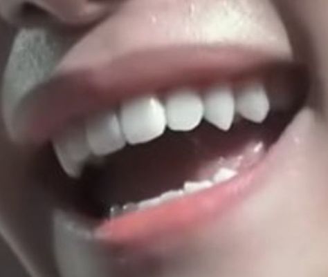 Long Canines Teeth Human, Sharp K9 Teeth Human, K9 Teeth Human, Permanent Vampire Fangs, Pointy Canine Teeth, Sharp Canines Human, Canine Teeth Human Aesthetic, Natural Vampire Teeth, Sharp Canine Teeth Human