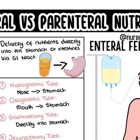 Dr. Nurse Vicky (Fiskvik Antwi) on Instagram: "Wondering what is the difference between enteral and parenteral nutrition? Here is a quick review nursing students!
.
.
.

#nclexpn #nclexrn #nclexstudying #nclexprep #nclexreview #nclextips #nclexhelp #nurseintraining #futurern #futurerns #futurernbsn #futurenurse💉 #futurenursepractitioner #nurseinprogess #studynursing #nursepractitionerstudent #nursingstudent #nurseschool #lpnstudent #lpns #nursestudents #nursingschool #nclex #rn #rnstudent #nurse" Nutrition Nursing, Parenteral Nutrition, Lpn Student, Nurse Practitioner Student, Nclex Pn, Nclex Review, Nclex Prep, Future Nurse, Nursing Study