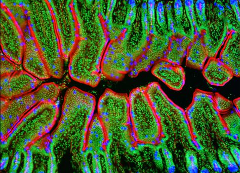 Fluorescence Microscopy | Nikon MicroscopyU | Fluorescence Microscopy Digital Image Gallery Fluorescence Microscopy, Microscopic Photography, Micro Photography, Cells And Tissues, Microscopic Images, Science Geek, Medical Anatomy, Things Under A Microscope, Book Projects