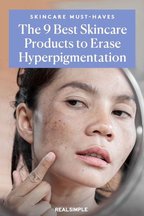 Hyperpigmentation Remedies, Best Dark Spot Corrector, Regrow Hair Naturally, Skin Lightener, Brown Spots Removal, Dark Spot Corrector, Acne Care, Regrow Hair, Dark Under Eye