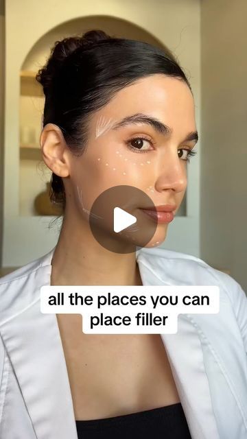 Miranda Wilson MSN-FNP on Instagram: "*** all the places I place dermal filler‼️‼️ . . . There are providers that do inject the nose however I do not put filler in the nose due to high risk of vascular occlusions! the same goes for the forehead.  . . . Comment below with your favorite spot for filler!  . . #filler #antiaging #dermalfiller" Forehead Filler Before And After, Natural Fillers For Face, Nasiolabel Folds Filler, Cheek Filler Injection Sites, Upper Blephoraplasty, Facial Contouring Fillers, Nose Filler Before After Non Surgical, Smile Line Fillers Before And After, Nose Filler Before After