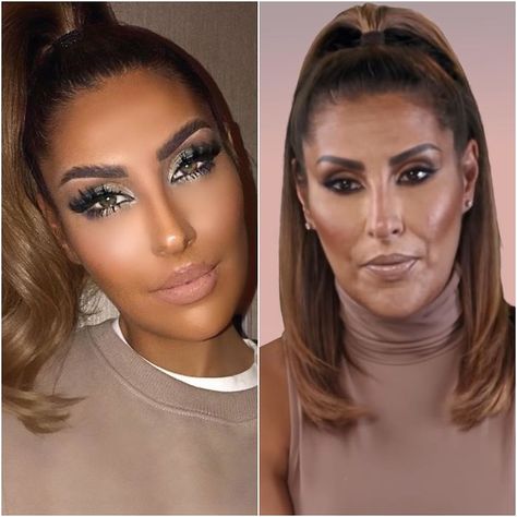 Instagram vs. Reality Bad Celebrity Plastic Surgery, Instagram Photoshop, Plastic Surgery Photos, Botox Lips, Instagram Vs Real Life, Instagram Vs Reality, Makeup Fails, Celebrity Plastic Surgery, Hair And Makeup Tips