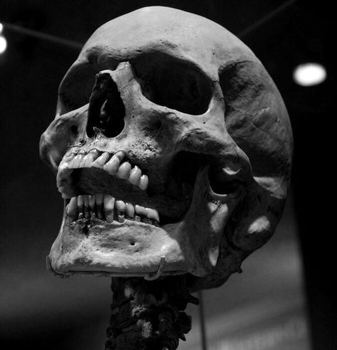 Skulls Black And White, Skull Looking Up Reference, Black And Grey Photography, Skeleton Photography, Human Skull Photography, Skull Photography, Skull Human, Skull Anatomy, Anatomy Bones