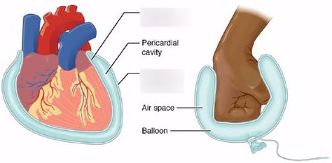 Write: parietal vs visceral 2 | Quizlet Ventral Cavity, Anatomical Terminology, Free College Textbooks, Serous Membrane, Thoracic Cavity, Cardiothoracic Surgery, Biology Worksheet, College Textbook, Free Textbooks