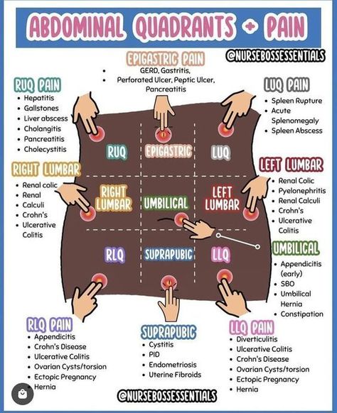 Nursing Tools, Nursing School Studying Cheat Sheets, Emt Study, Paramedic School, Nursing School Essential, Nursing Assessment, Medical School Life, Nursing School Motivation, Nursing Study Guide