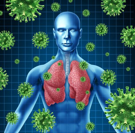 Lung infection. Represented by a human with x-ray image of the lungs and body wi , #Ad, #image, #ray, #body, #lungs, #infection #ad Mucus In Throat, Getting Rid Of Mucus, Clear Lungs, Foods High In Magnesium, Home Remedies For Bronchitis, Lung Infection, Persistent Cough, How To Make Drinks, Chest Pain