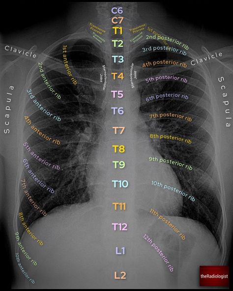 Radiology Technician Aesthetic, Radiology Student Aesthetic, Dental Notes, Radiography Student, Radiology Schools, Medical Radiography, Medical Assistant Student, Radiology Student, Radiology Technician