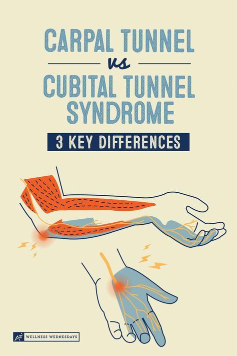 Hand Stretches Carpal Tunnel Exercise, Stretches For Carpal Tunnel, Carpultunal Exercise, How To Help Carpal Tunnel, Cubital Tunnel Syndrome Exercises, Hand Exercises For Carpal Tunnel, Carpel Tunnel Stretch, Carpal Tunnel Taping, Cubital Tunnel Syndrome Relief