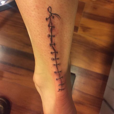 Suture Line Tattoo, Hyperrealism Tattoo, Scars Tattoo, Boss Tattoo, Character Tattoos, Tattoos To Cover Scars, Tattoo Time, Worlds Best Tattoos, Scar Tattoo