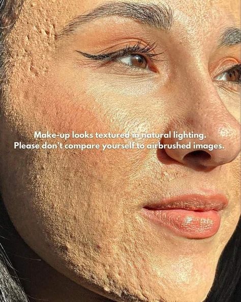 Real Makeup Texture, Real Skin Texture Makeup, Girl With Acne, Acne Positivity, Heat Rash, Real Bodies, Indian Makeup, Remove Dark Spots, Skin Care Solutions