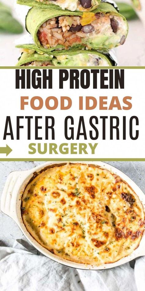 Are you looking for bariatric recipes gastric bypass high protein low carb foods that are tasty and filling? We’ve compiled a list of easy for Gastric Bypass Patients that are high in protein perfect to help you in your weightloss journey.Low Carb Recipes|Bariatric Recipes|Bariatric Surgery #NoCarbDietRecipes Gastric Bypass Meal Plan, High Protein Bariatric Recipes, Full Liquid Diet, Liquid Diet Recipes, Bariatric Recipes Sleeve, Gastric Bypass Recipes, Bariatric Meals, Soft Foods Diet, Low Carb Foods