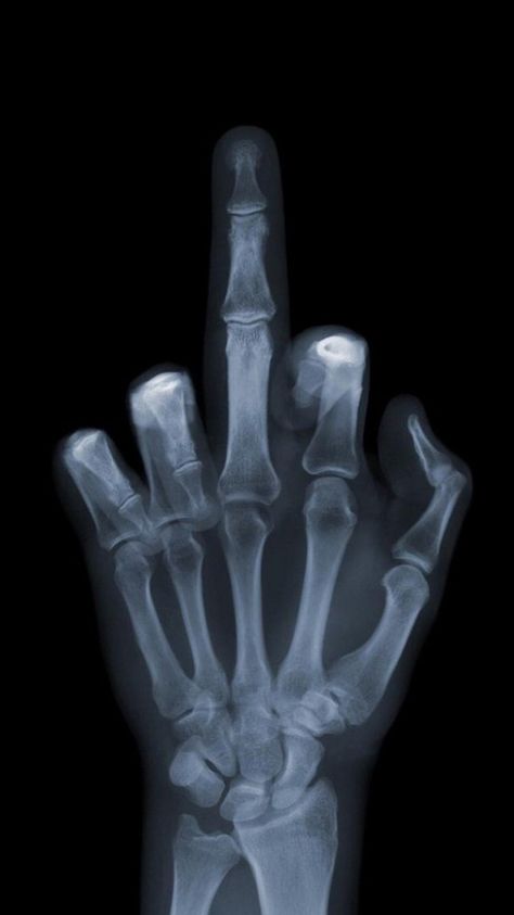 Hand X-Ray Middle Finger Wallpaper, Romain Gary, Iphone 5 Wallpaper, Luxury Printing, Hd Phone Wallpapers, Free Iphone Wallpaper, Trendy Wallpaper, New Backgrounds, Screen Wallpaper