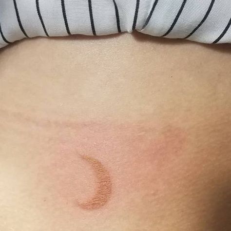 Jasmine Waller on Instagram: "This client wanted her tattoo very subtle. So we decided to make it look like a birthmark. I think this little moon is ADORABLE !" Unique Birth Marks, Tattoos Around Birthmarks, Birth Mark Tattoo Ideas, Crescent Moon Birthmark, Moon Birthmark, Cute Birthmarks, Tattoos On Freckled Skin, Targaryen Child, Little Moon Tattoo