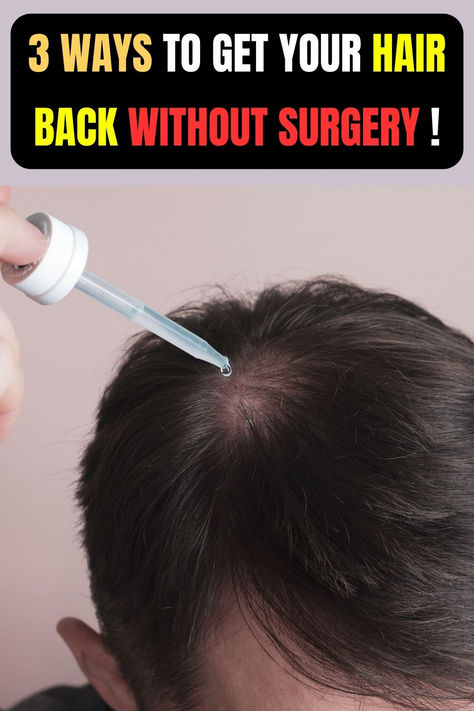 Common remedies that may help to stop balding include good hair care practices, rosemary oil, scalp massages, and stress management #hair #balding #hairloss #regrowhair #losthair #hairthinning Regrow Hairline, How To Regrow Hair, Regrow Hair Naturally, Hair Growth For Men, Face Pores, Hair Nutrition, Thicker Fuller Hair, Hair Remedies For Growth, Regrow Hair