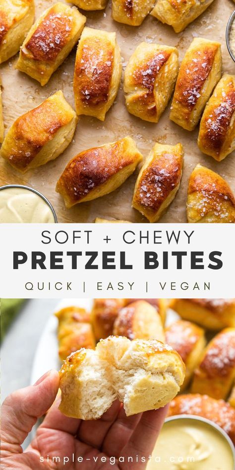 L Lysine Foods, Easy Soft Pretzel Bites, Lysine Foods, Soft Pretzel Bites Recipe, Homemade Soft Pretzel Bites, Homemade Pretzel Bites, Pretzel Bites Recipe, Homemade Pretzel, Soft Pretzel Bites