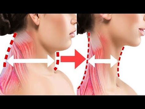 Slim Neck And Shoulders Exercise, Exercise For Neck Double Chin, Double Neck Exercise, Neck Slim Exercise, How To Make My Neck Thinner, Tall Neck Exercise, Elongate Neck Exercise, Neck Fat Loss Exercise, Chin And Neck Exercises