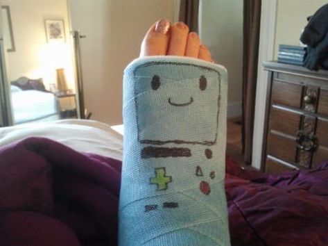 13 Pieces Of Cast Art That Make Breaks Seem Not So Bad - Give It Love Long Leg Cast, Arm Cast, Leg Cast, Cast Art, Broken Arm, Laughing And Crying, Broken Leg, Anime Base, Plaster Art