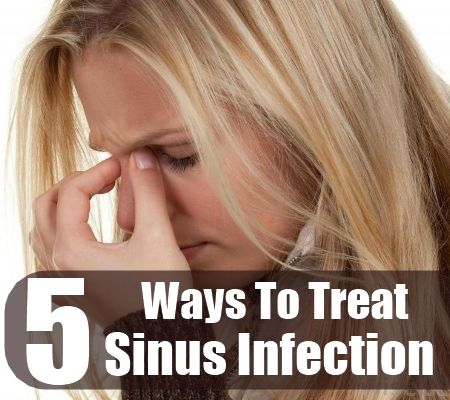 5 Effective Ways To Treat Sinus Infection Nasal Polyps Remedies, Sinusitis Remedies, Allergies Remedies, Nasal Polyps, Relieve Sinus Congestion, Home Remedies For Sinus, Peroxide Teeth Whitening, Cystic Acne Remedies, Stuffy Nose Remedy