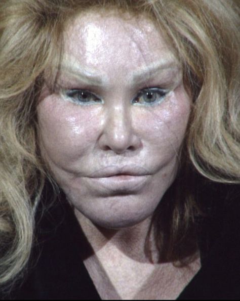 'Catwoman' socialite Jocelyn Wildenstein is shown here in her mug shot from Wednesday when... Botched Plastic Surgery, Plastic Surgery Fails, Face Transformation, Plastic Surgery Fail, Face Surgery, Plastic Surgery Gone Wrong, Celebrity Plastic Surgery, Analog Horror, Pop Dolls