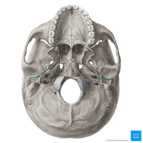 Petrotympanic fissure (Fissura petrotympanica); Image: Yousun Koh Occipital Bone Anatomy, Palatine Bone, Occipital Bone, Sphenoid Bone, Anatomy Images, Body Bones, Skull Anatomy, Anatomy Bones, Head Anatomy