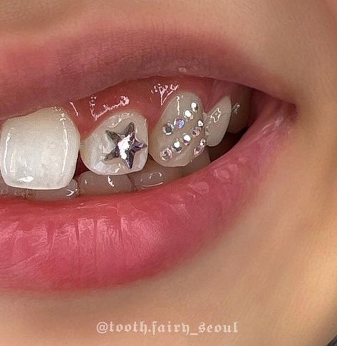 Teeth Crystals, Smiley Piercing Aesthetic, Teeth Gems, Pretty Teeth, Dental Jewelry, Grillz Teeth, Diamond Teeth, Tooth Gems, Grills Teeth