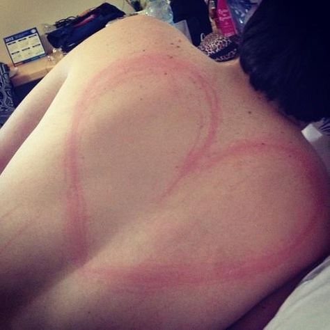 scratches on a boys back Nail Marks On Back, Back Scratches From Nails, Mine Scratched On Back, Nails Scratching On Back Couple Pic, Nail Scratches Back, Scratched Back From Nails Men Aesthetic, Back With Scratches, Back Scratches From Nails Boyfriend, Heart Hickies Neck