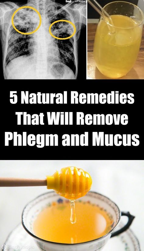 5 Natural Remedies That Will Remove Phlegm and Mucus Best Cough Remedy, Baby Cough Remedies, Homemade Cough Remedies, Dry Cough Remedies, Cold And Cough Remedies, Home Remedy For Cough, Cold Sores Remedies, Nasal Passages, Natural Sleep Remedies