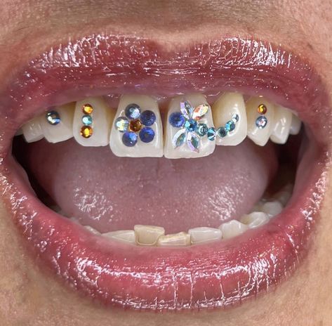 Cool Tooth Gems, Teeth Gem Designs, Teeth Decorations, Tooth Gem Placement, Christmas Outfits Teens, Teeth Gems, Pretty Teeth, Grillz Teeth, Diamond Teeth