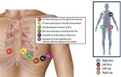 Ekg Placement, Phlebotomy Study, Er Tech, Emt Study, Ekg Interpretation, Ecg Interpretation, Medical Assistant Student, Nurse Study, Nurse Study Notes