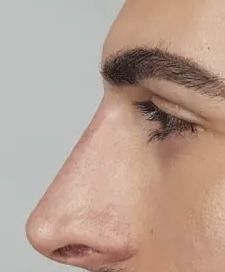 Jawline Men, Nose Surgery Rhinoplasty, Upturned Nose, Hooked Nose, Human Anatomy Reference, Straight Nose, Big Nose Beauty, Perfect Nose, Nose Shapes