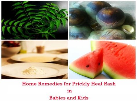 Get rid of prickly heat rash with these simple and effective home remedies during the scorching hot summers. These are all test and tried remedies Prickly Heat Rash Remedies, Heat Rash Remedy, Prickly Heat Rash, Rash Remedies, Rashes Remedies, Prickly Heat, Heat Rash, Baby Care, Hot Summer