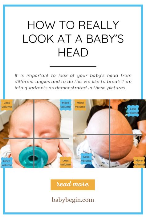 This will give you a good visual about VOLUME DIFFERENCES. Once you can really see each area in this way, you can assess where the flattening and fullness is. Keep in mind, mild inconsistencies or small areas of flattening or little bulges here and there are nothing to worry about. You want to see if there are large areas of asymmetries. We want as much symmetry as we can get in the large areas. This will involve positioning AND really effective neck stretches. We can help you! Head From Different Angles, Neck Stretches, Baby Head, Parenting Tips, Keep In Mind, Parenting Hacks, Assessment, No Worries, Look At