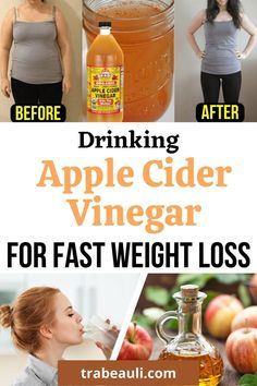 Drinking apple cider vinegar for weight loss fast. Know about how to use it and benefits of it. #ACV #weightloss Drinking Apple Cider Vinegar, Vinegar Drinks, Lose Stomach, Baking Powder Uses, Apple Cider Vinegar Drink, Baking Soda Beauty Uses, Cold Sores Remedies, Organic Apple Cider Vinegar, Natural Cough Remedies