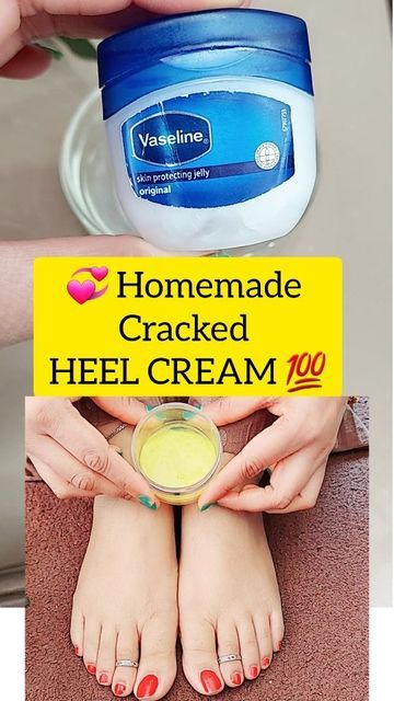 Shalini ♥️ Skin & Hair care 💁‍♀️ on Instagram: "😱 Homemade cracked Heel Cream 💁‍♀️💁‍♀️💁‍♀️ Use this simple home remedy to get rid of dry cracked heels in 7 days... First soak your feet in warm water and remove dead skin well and start this cream application and wear socks ...keep ot overnight...🤗🤗🤗🤗🤗 Ingridents ✅ ALOEVERAGEL + Mustard oil + Vaseline + TURMURIC . . Follow @beauty_secrets_with_shalini 🥰🥰🥰🥰 . . . #beautytips #beautyhacks #crackedheels #pedicure #pediatria #crackedheel Cracked Heels Remedy Overnight, Cracked Feet Remedies, Dry Feet Remedies, Cracked Heel Remedies, Feet Remedies, Soothing Face Mask, Dry Cracked Heels, Cracked Heel, Dead Skin Removal