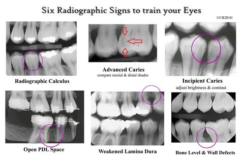 Dental Assistant Study Guide, Dental Assistant School, Dental Hygienist School, Dental Assistant Study, Dental Hygiene Student, Dental World, Kedokteran Gigi, Dental Hygiene School, Dentistry Student