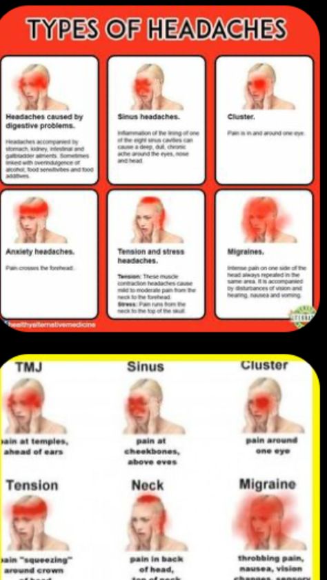 Frontal Lobe Headache, Types Of Headaches Chart, Headache Location Meaning, Headache Location, Headache Chart, Different Types Of Headaches, Remedy For Sinus Congestion, Home Remedies For Sinus, Sinus Congestion Relief