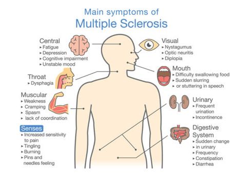 Ms Symptoms, Nerve Fiber, Yellow Fever, Muscle Weakness, Nerve Damage, Neurological Disorders, Central Nervous System, Nerve Pain, Signs And Symptoms